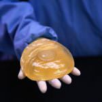 La chirurgia estetica non risente della crisi