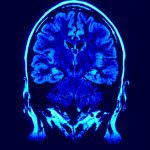 Salute, presentata la Consulta delle malattie neuromuscolari