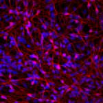 Obama ends embryonic stem-cell research ban