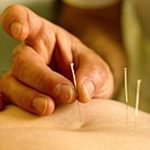 Così l'agopuntura toglie il dolore