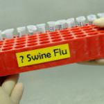 Trieste: Un caso di influenza AH1N1