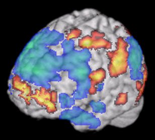 Sclerosi multipla e cellule staminali: ecco le linee guida