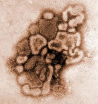 Influenza A, il virus provoca la follia degli anticorpi