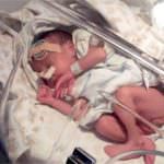 Torino: ecco la proteina salva vita per i neonati sottopeso