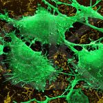 Una molecola ferma la crescita del cancro