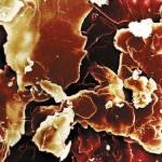 Meno colesterolo cattivo, vita più lunga