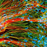 Cellule staminali: ecco la loro fonte della giovinezza