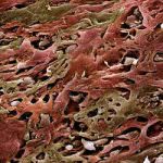 Individuato il gene Myc, antenato dei tumori