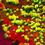 L'Influenza suina sarà una catastrofe. O forse no