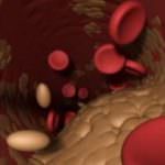 Semi di lino contro il colesterolo