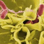 Usare la salmonella per distruggere i tumori