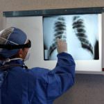 Influenza A. Meno istruzione, rischio più alto