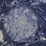 Isolate le cellule staminali del seno