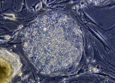 Cellule staminali da liquido amniotico: il futuro della medicina è qui