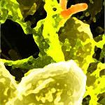 FANCL: la proteina che difende i tumori