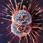 Il tumore al pancreas corrompe il sistema immunitario