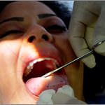 Il dolore per perdere peso: ecco la "museruola" anti goloso