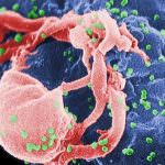 AIDS: cellule staminali modificate contro HIV