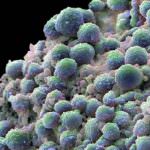 Tumori: identificati i geni che li nutrono