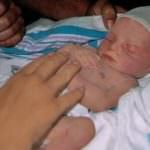 Gli omega-3 proteggono i neonati sottopeso dalle malattie cardiovascolari