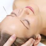 L'agopuntura combatte i dolori della gravidanza