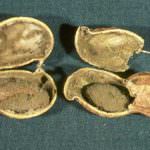 Aflatossina: così si forma e così si sconfigge