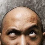 Calvizie: la vitamina E aiuta la ricrescita dei capelli