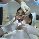 Addio trapano del dentista. Contro le carie, un getto di plasma