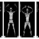 Body Scanner: Fazio rivede le dichiarazioni sulla pericolosità per la salute dei cittadini