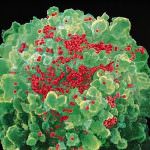 AIDS: ecco l'enzima che diffonde il virus