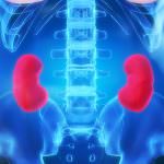 Calcoli renali: con l'obesità, il rischio è doppio