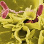 EFSA publishes survey on Campylobacter and Salmonella in chicken in the EU