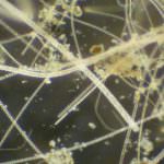 Tbc: due nuovi modi per colpire il batterio