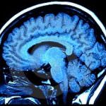 Il cervello dei razzisti è insensibile al dolore degli "altri"