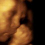 Gli ormoni tiroidei della madre costruiscono il cervello del feto