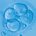 Sclerosi multipla: al via i test con le cellule staminali