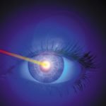 Puntatori laser, un pericolo per gli occhi