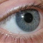 Con un'alimentazione corretta le donne prevengono la cataratta