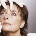 Stop al lifting, la chirurgia estetica passa per la mappa delle rughe