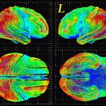 Buoni i risultati con cavie animali, ora tocca alla sperimentazione con volontari umani