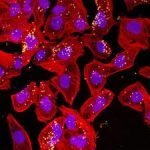 Un test per rilevare la meningite in un ora