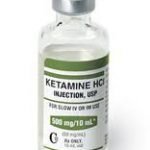 Fattore K: la Ketamina contro i casi gravi di depressione