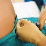 L'epidurale protegge i muscoli ed evita il problema incontinenza