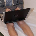 Tieni il computer sulle gambe nude? Attento alla sindrome da tostapane