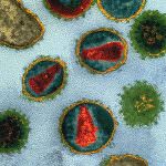 Dalla bufala del vaccino Trevisanato al gc maf di Nobuto Yamamoto: quali speranze per la cura del cancro e dell'AIDS-HIV?