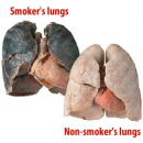 Gran Bretagna, polmoni di fumatori usati nei trapianti d’organo