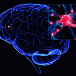 Ictus: congelare il cervello per ridurre i danni e guarire meglio