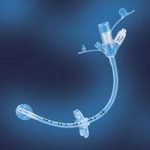 La dieta del sondino arriva in Gran Bretagna