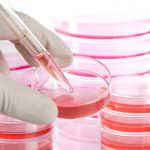 Metodo stamina, il prof. Tirelli: "E'necessario rispettare una procedura come per tutti i farmaci"