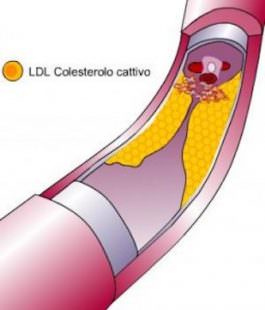 colesterolo cattivo LDL